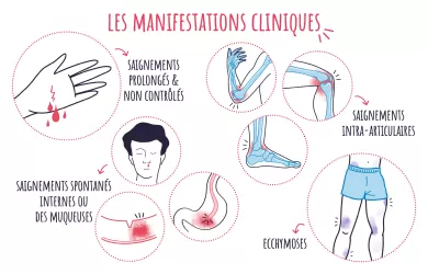illustrations des différents types de manifestations cliniques en hémophilie